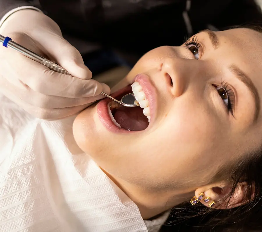 Estética Dental - Carillas